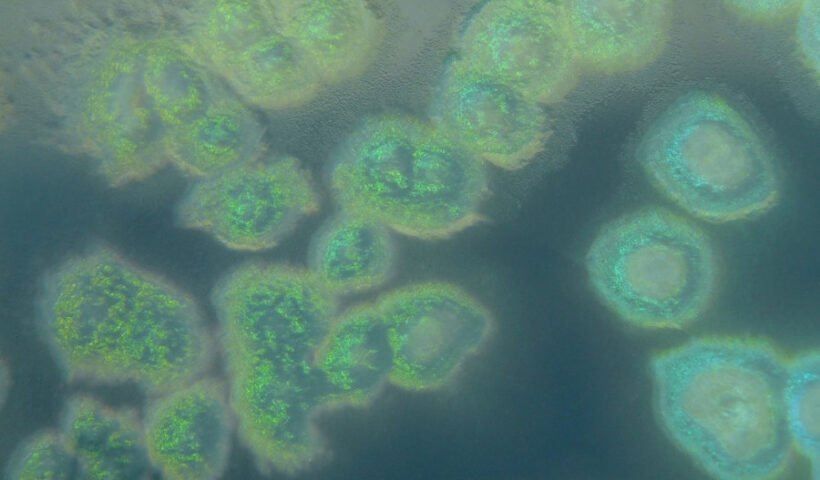Pseudomonas aeruginosa Créditos: By HansN. - Own work, CC BY-SA 3.0, https://commons.wikimedia.org/w/index.php?curid=23249600