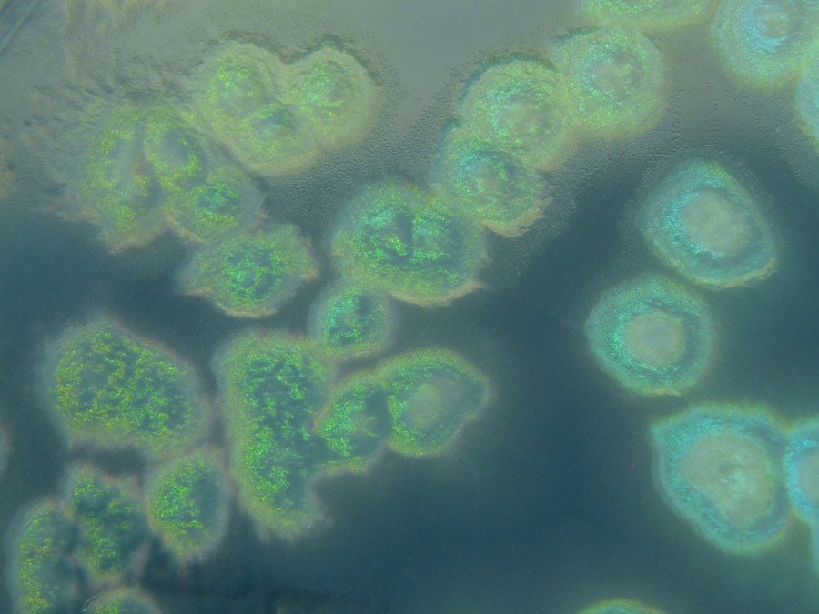 Pseudomonas aeruginosa Créditos: By HansN. - Own work, CC BY-SA 3.0, https://commons.wikimedia.org/w/index.php?curid=23249600