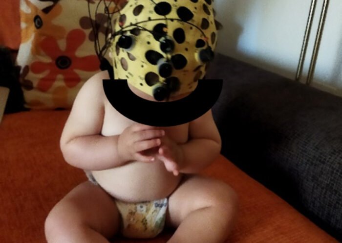 Bebé preparado para un EEG (Rocío Llamas)