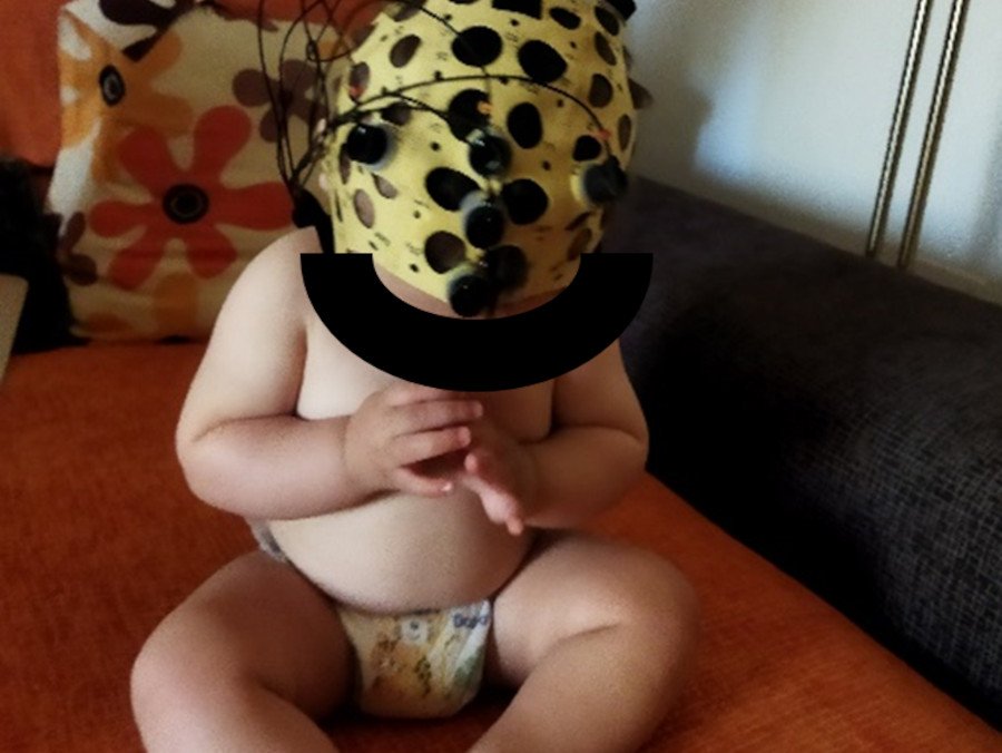 Bebé preparado para un EEG (Rocío Llamas)