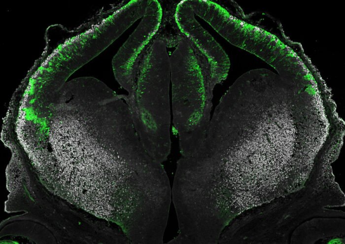 Imagen confocal de un embrión de ratón E13.5 transfectado con un vector para la expresión ectópica del factor de transcripción Dbx1, lo que conduce a la formación de agregados celulares debido al aumento de la adhesión mediada por Pcdh8. La interacción entre Dbx1 y Pcdh8, tal como se describe en Cwetsch et al., regula el desarrollo de la corteza cerebral. Crédito de la imagen: Andrzej W. Cwetsch.