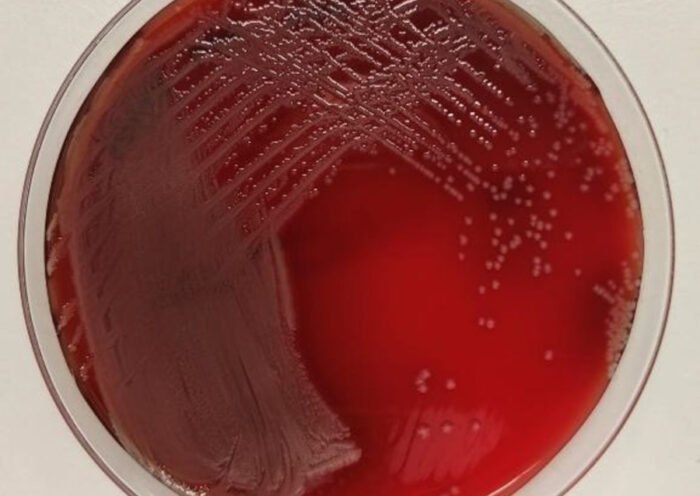 P.aeruginosa (Isabel M Barceló)