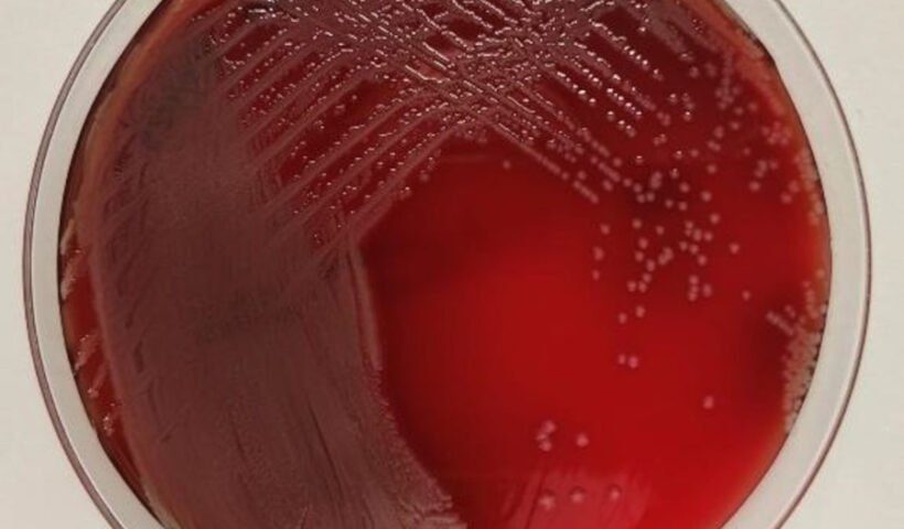 P.aeruginosa (Isabel M Barceló)