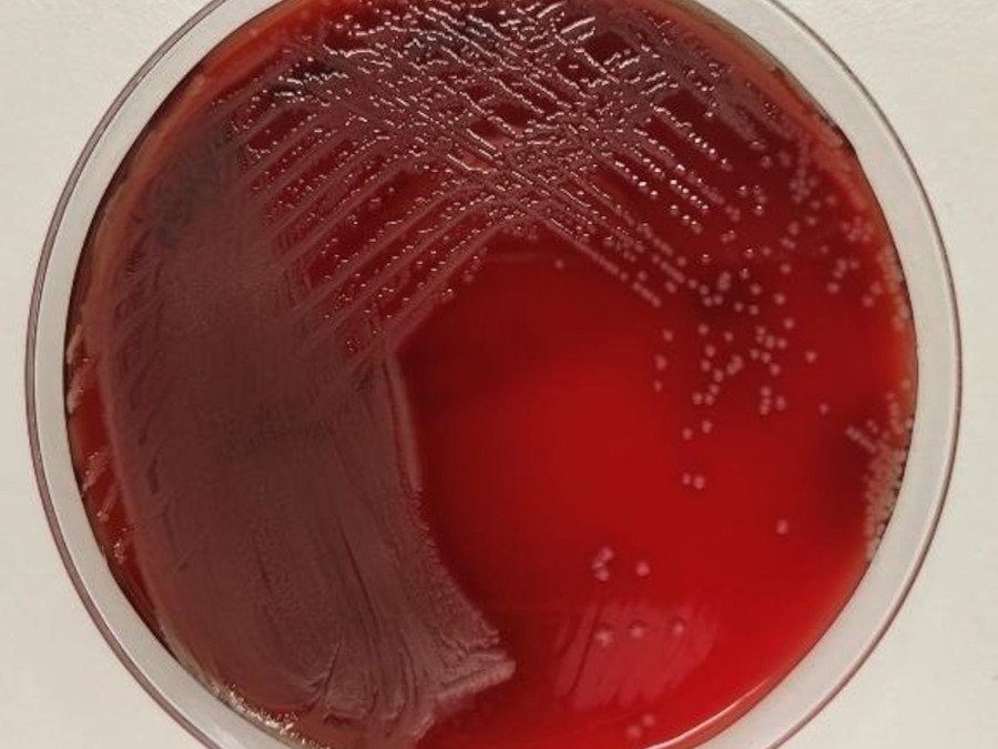 P.aeruginosa (Isabel M Barceló)