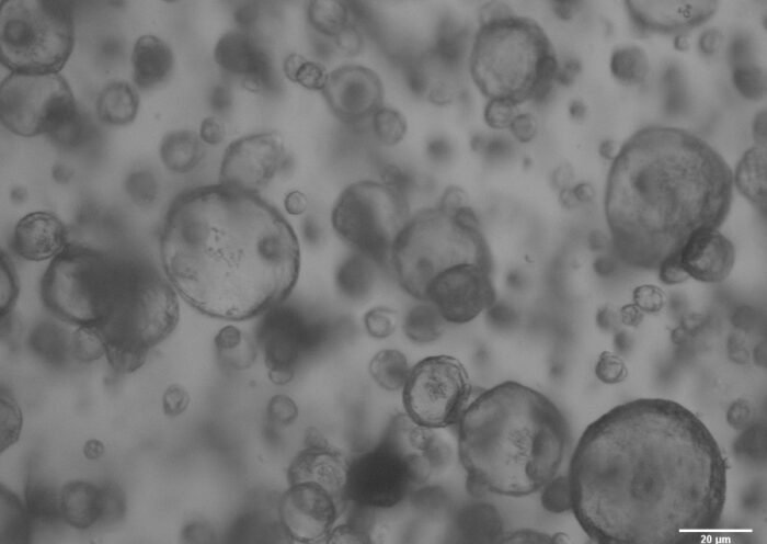Organoides pulmonares porcinos observados mediante microscopía de contraste de fases. Barra de escala 20 micras. Autor: Miguel Angel Cuesta Geijo
