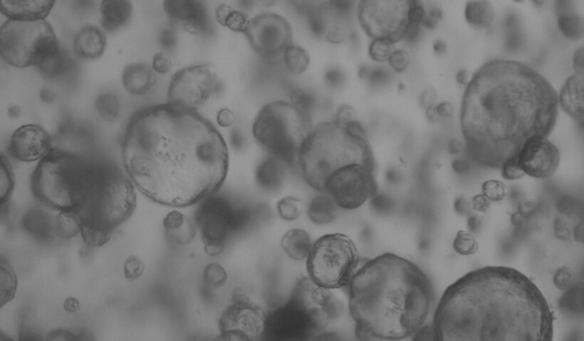 Organoides pulmonares porcinos observados mediante microscopía de contraste de fases. Barra de escala 20 micras. Autor: Miguel Angel Cuesta Geijo