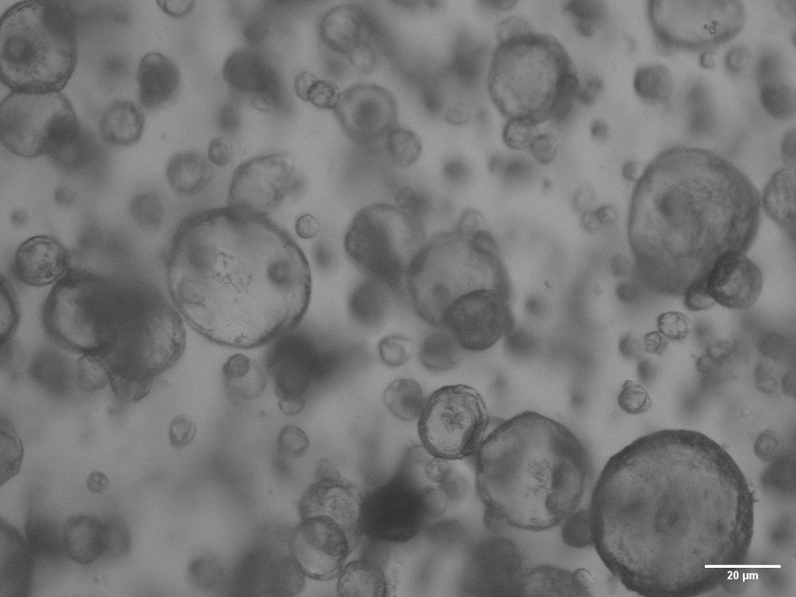 Organoides pulmonares porcinos observados mediante microscopía de contraste de fases. Barra de escala 20 micras. Autor: Miguel Angel Cuesta Geijo