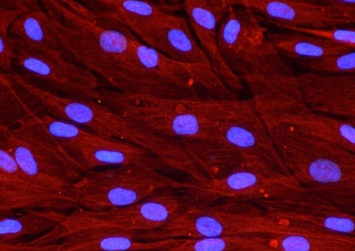 Vinculina, una proteína vinculada a la adhesión celular, en fibroblastos humanos, las células que dan soporte a la cicatrización de las heridas.(Autoría: Maria luisa Hernández Bule)