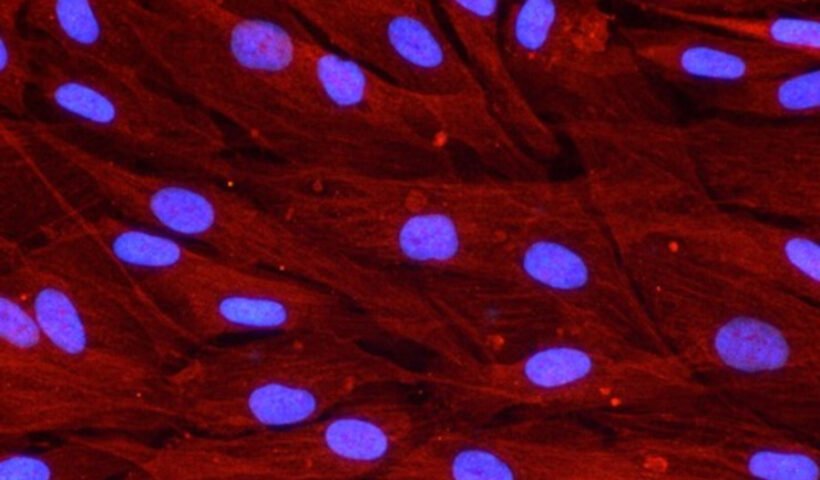 Vinculina, una proteína vinculada a la adhesión celular, en fibroblastos humanos, las células que dan soporte a la cicatrización de las heridas.(Autoría: Maria luisa Hernández Bule)