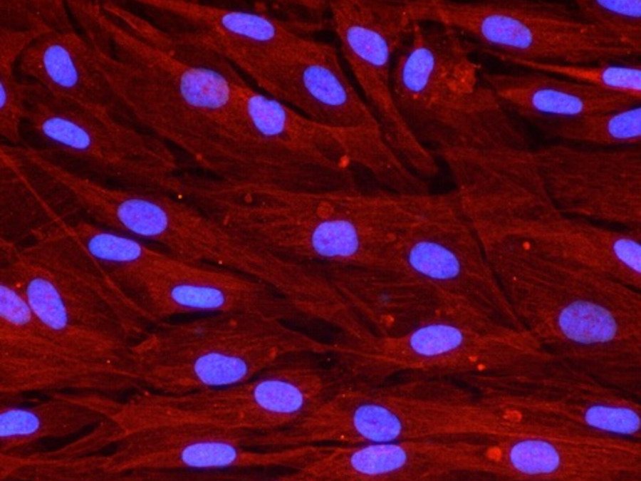 Vinculina, una proteína vinculada a la adhesión celular, en fibroblastos humanos, las células que dan soporte a la cicatrización de las heridas.(Autoría: Maria luisa Hernández Bule)